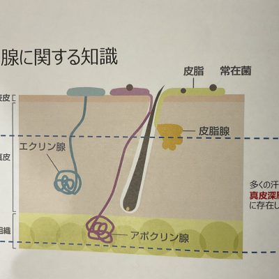 ワキガ　多汗症